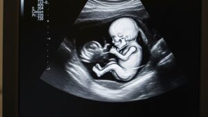 how to use a due date calculator for pregnancy planning